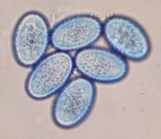 Scutellinia scutellata